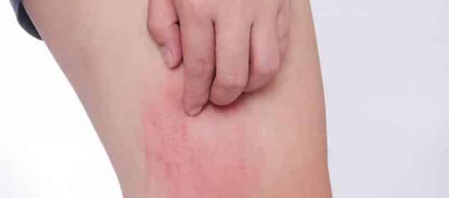 soñar con pulgas en las piernas